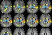 A series of colourful brain scans